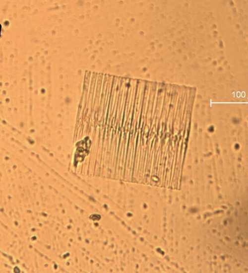 Fragilaria (Diatom)