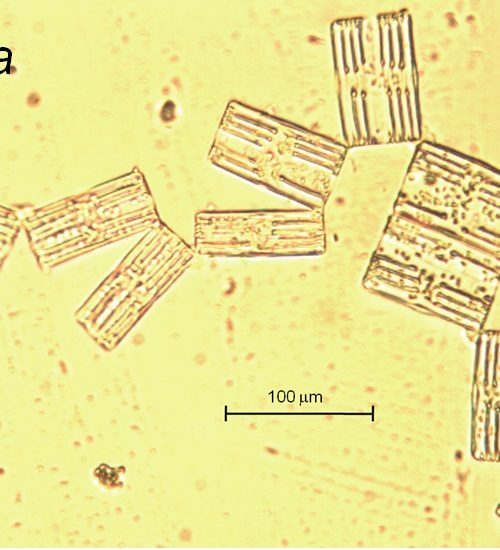 Tabellaria (Diatom)