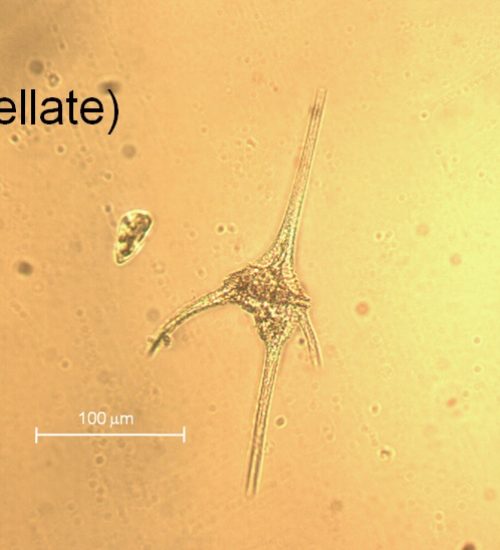 Ceratium (Dinoflagellate)